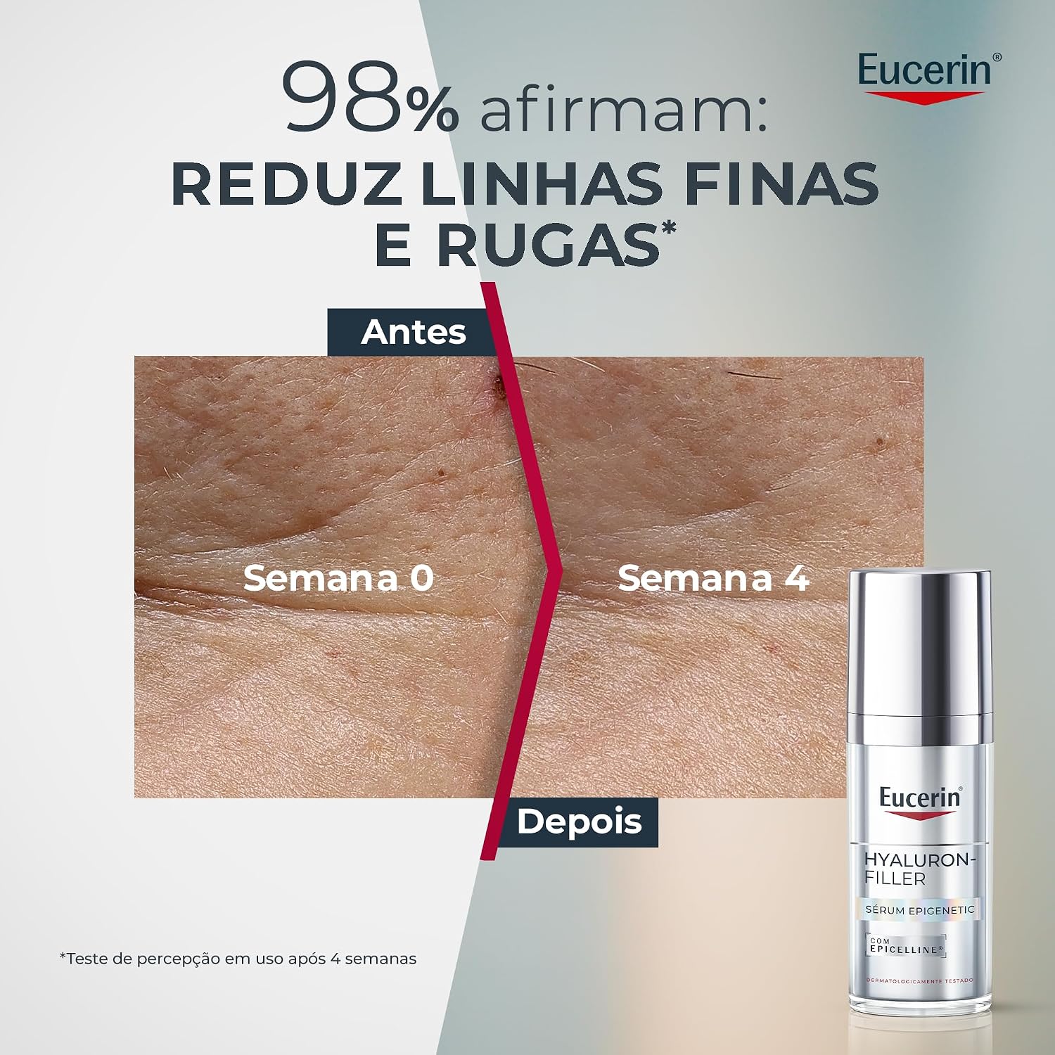 Esclarece os diferenciais de fórmula, como Epicelline, ácido hialurônico e ação antissinais.